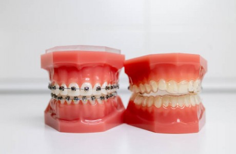 Ortodoncia. Descubre las distintas opciones para mejorar tu sonrisa -   